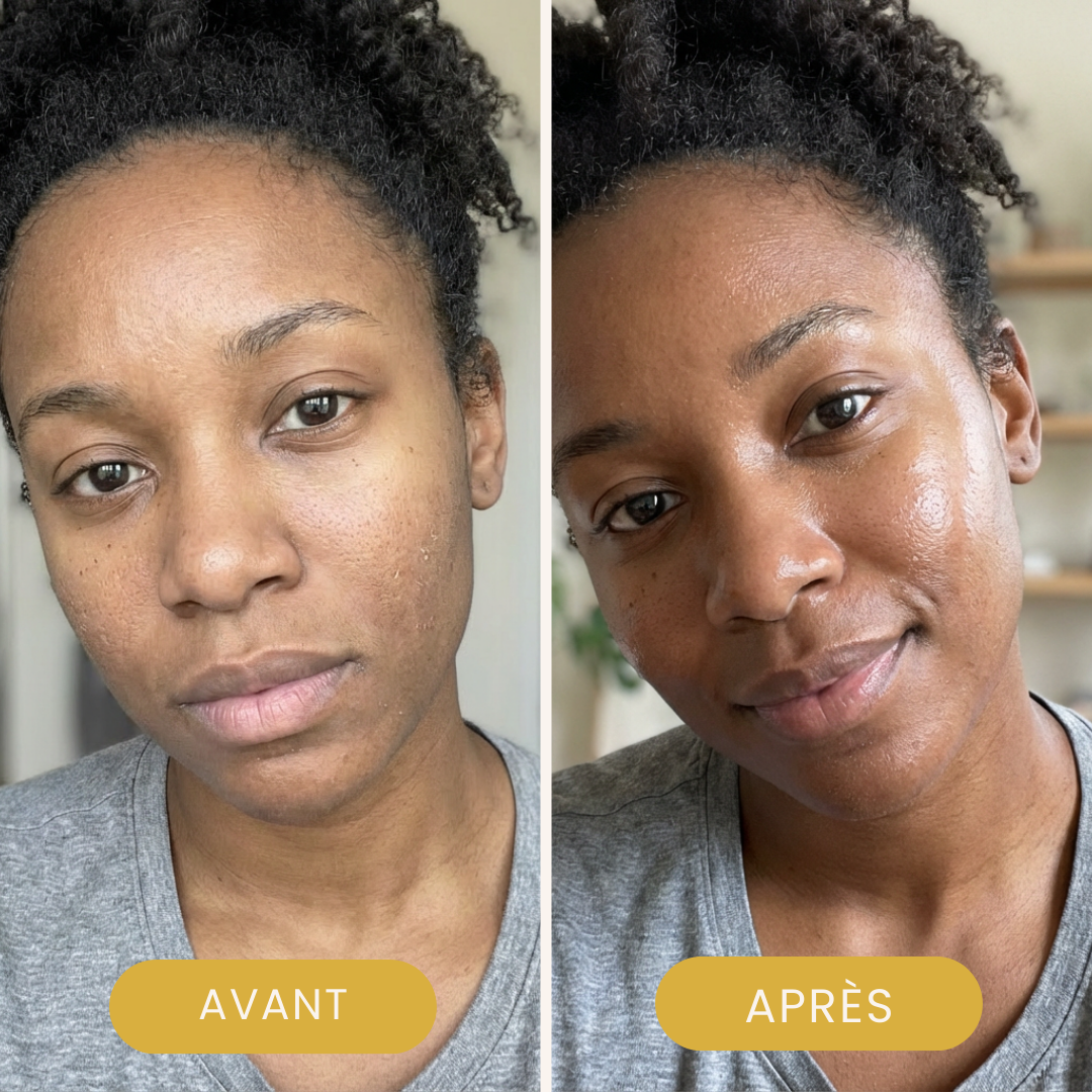 Booster à l’Acide Hyaluronique – Soin Visage Anti-Âge & Repulpant Intensif